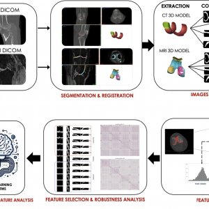 New publication: Innovative Diagnostic Approaches for Predicting Knee Cartilage Degeneration in Osteoarthritis Patients: A Radiomics-Based Study
