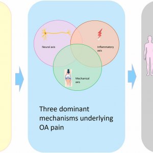 Publication: Mechanistic insights into cartilage-sensory nerve crosstalk in osteoarthritis progression